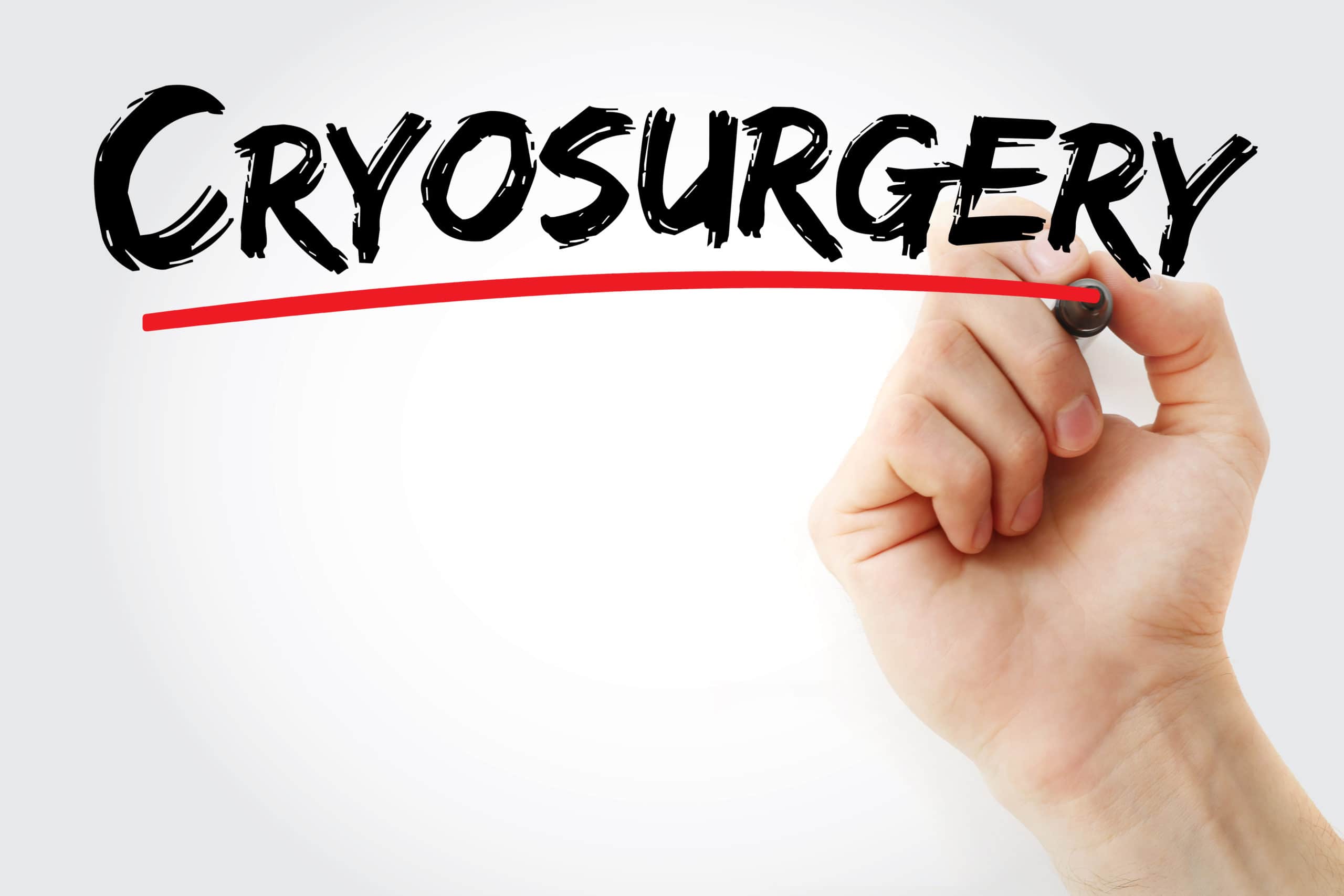 Cryosurgery