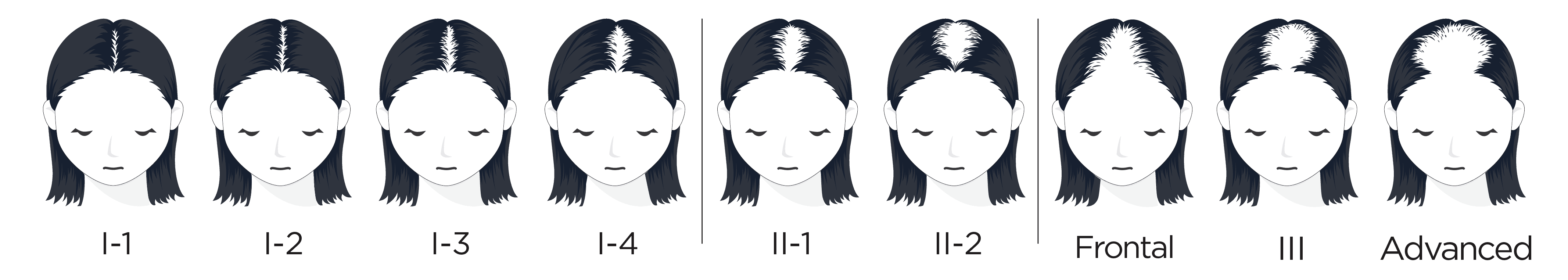 Ludwig_Scale